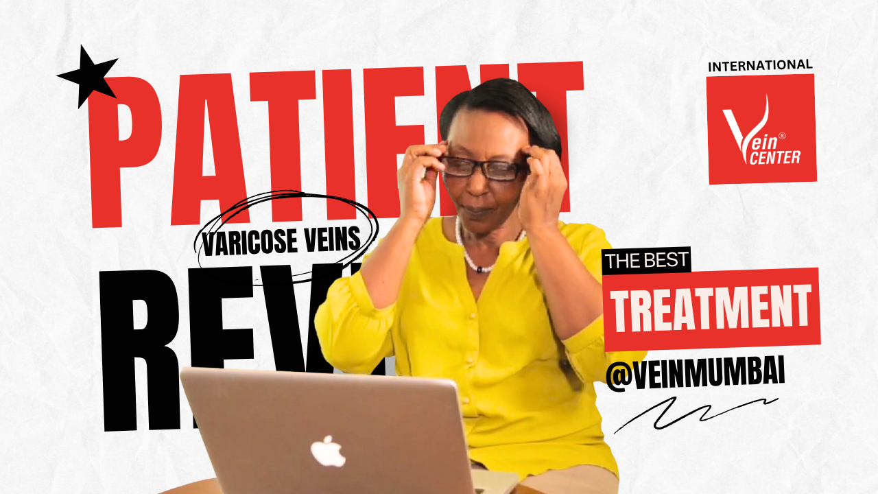international varicose veins patient experience (hq) (2)