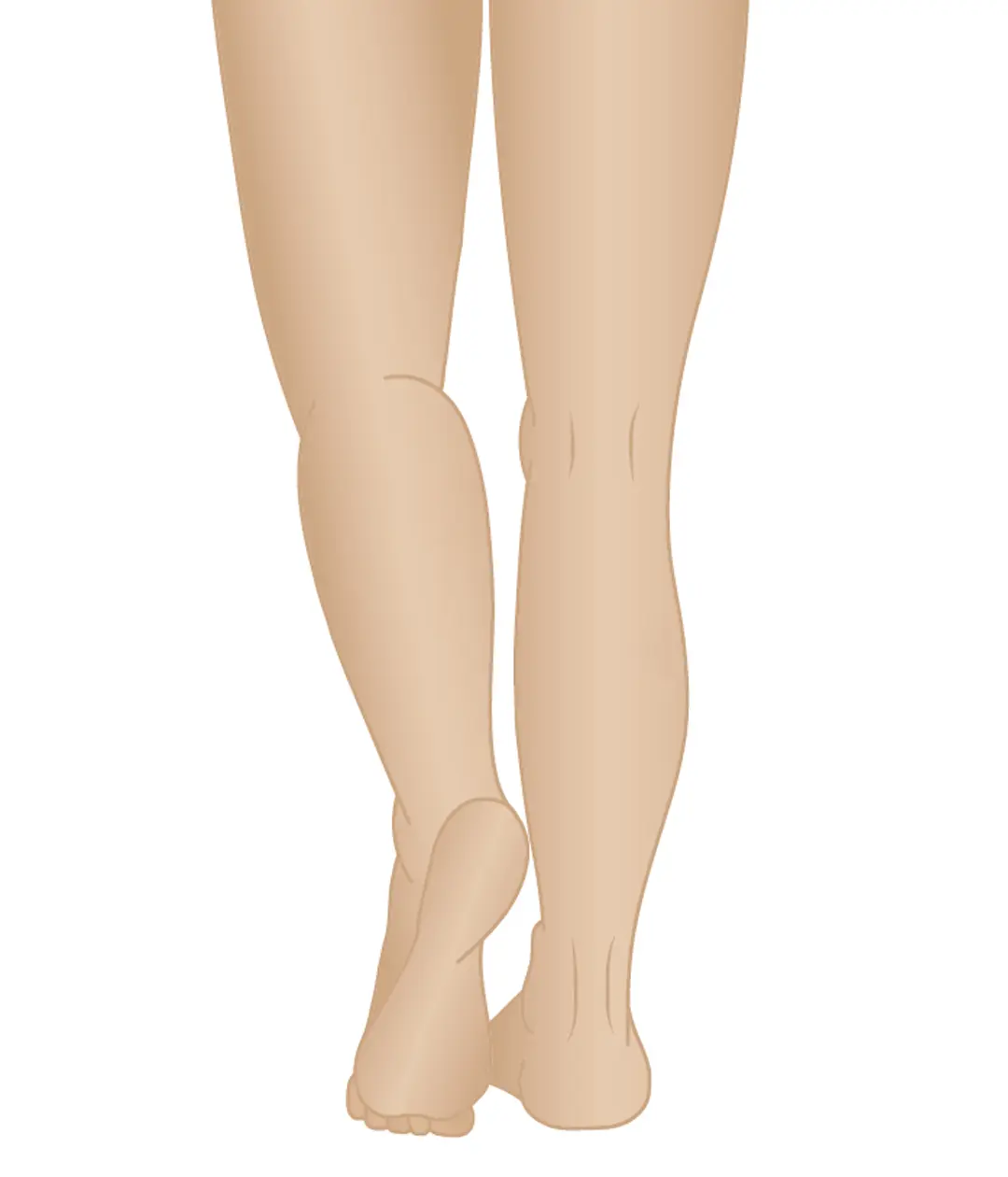 stages of varicose veins phase 1 normal leg