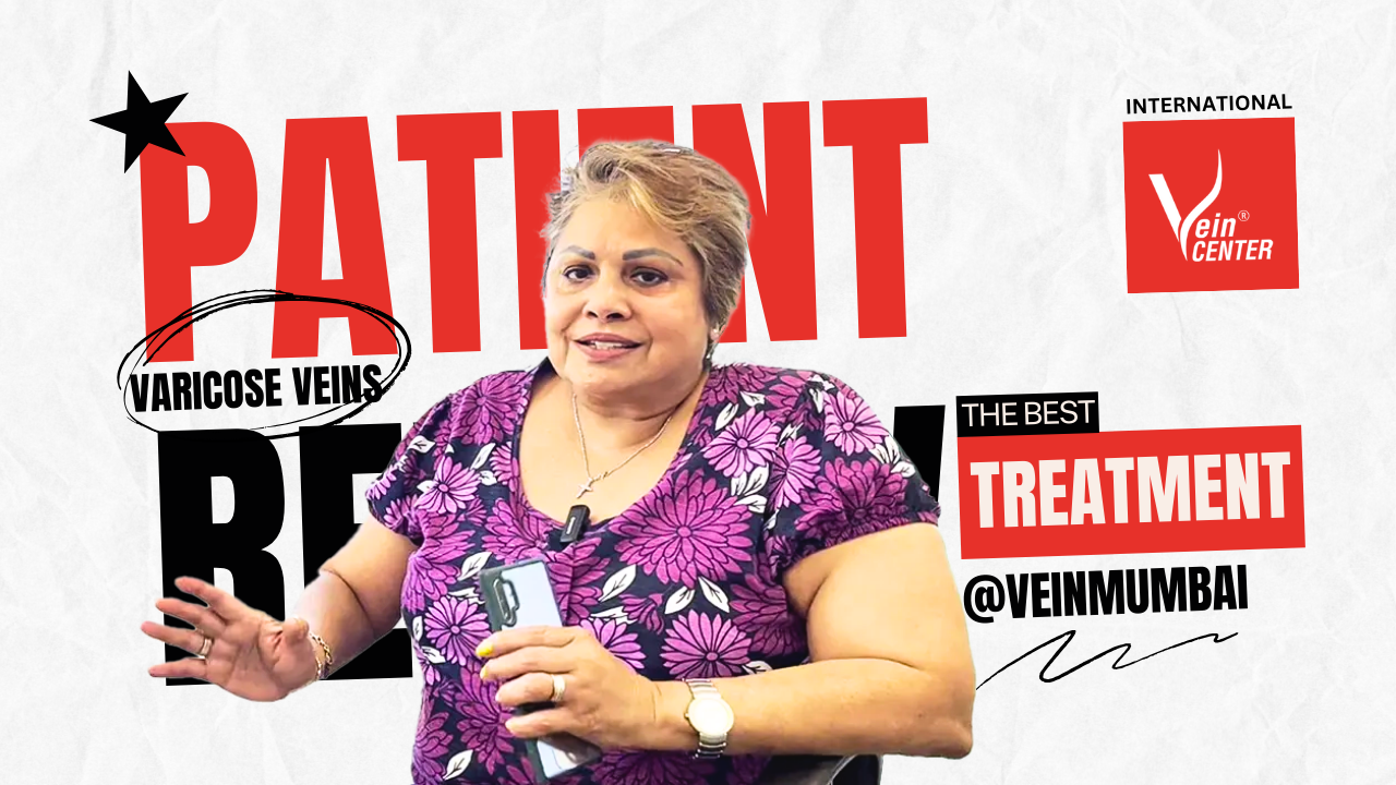 torina from kuwait varicose veins patient review in english at the vein center