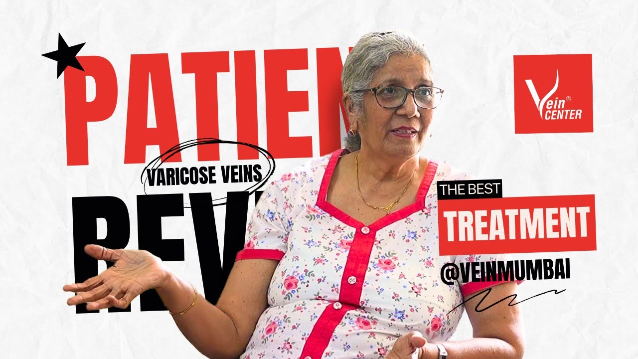 varicose veins my teacher's journey to healing venaseal treatment for varicose veins