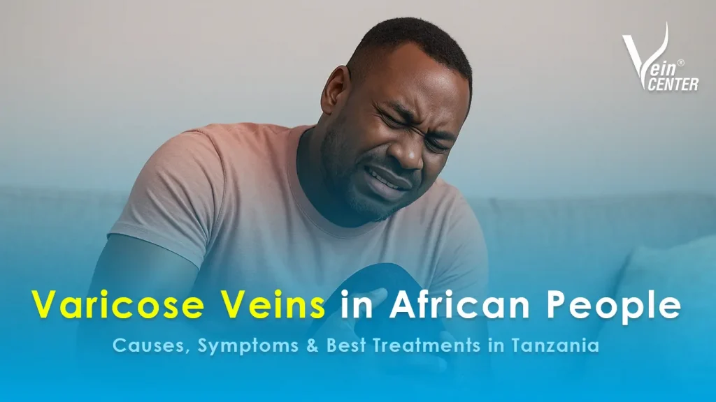 varicose veins in african people – causes, symptoms & best treatments in tanzania