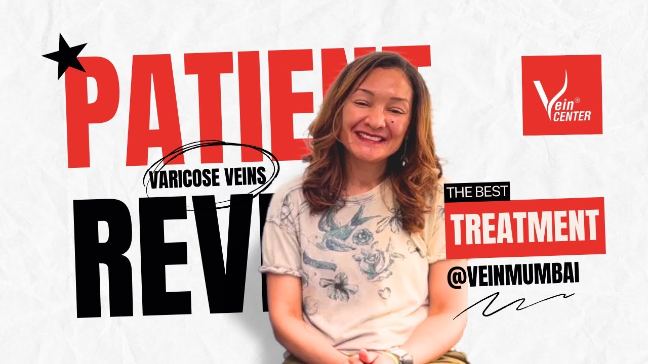 venaseal international patient review at the vein center