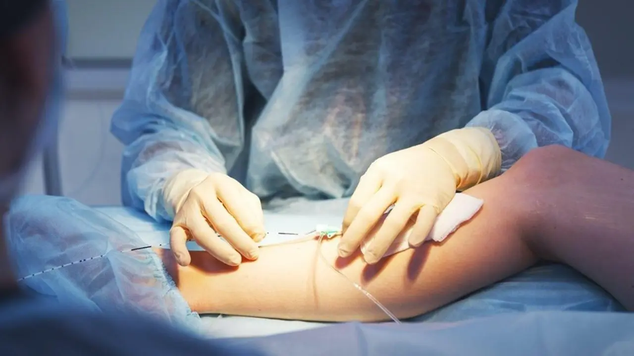 evla evlt laser treatment procedure varicose veins venous ulcers vein center tanzania